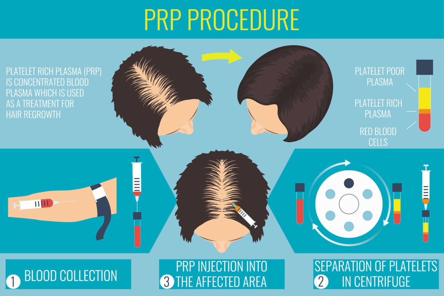 DHI, Direct Hair implantation FUE technique at IK Clinics