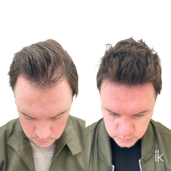 Before and After Image of a clients hair transformation
