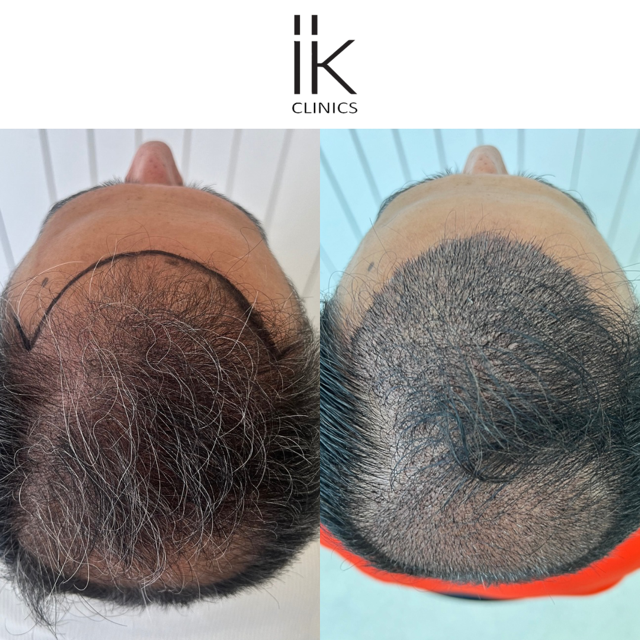 Image of Hair Care Treatment of a Client